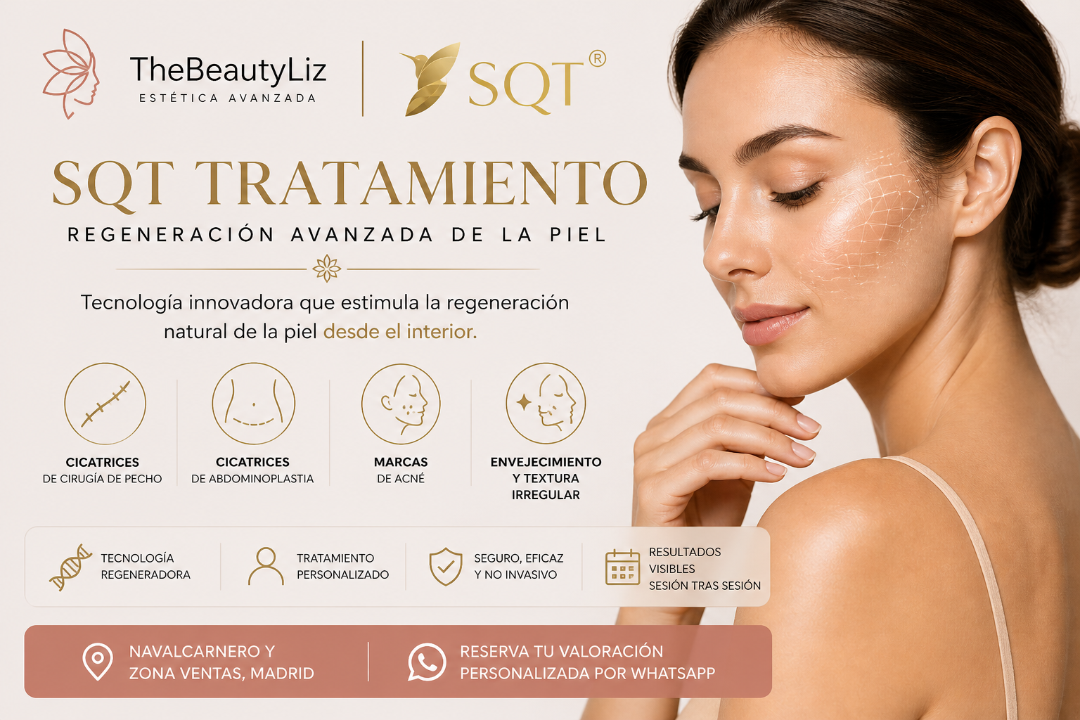 Tratamiento SQT estética avanzada Madrid